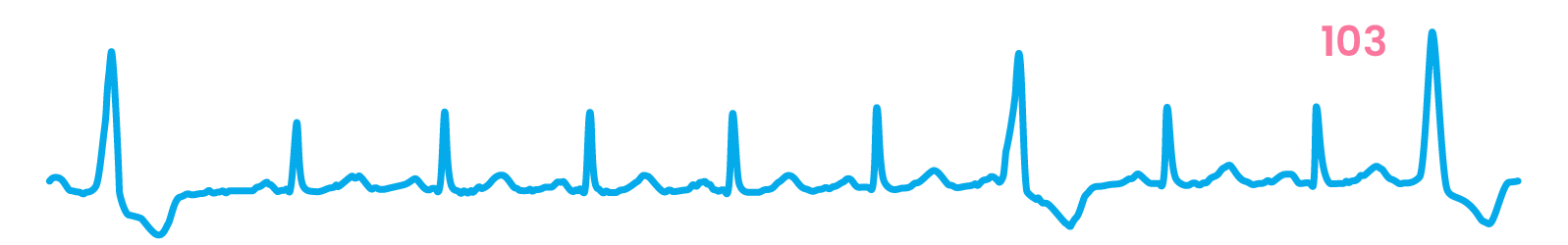 Practitioner ECG strip